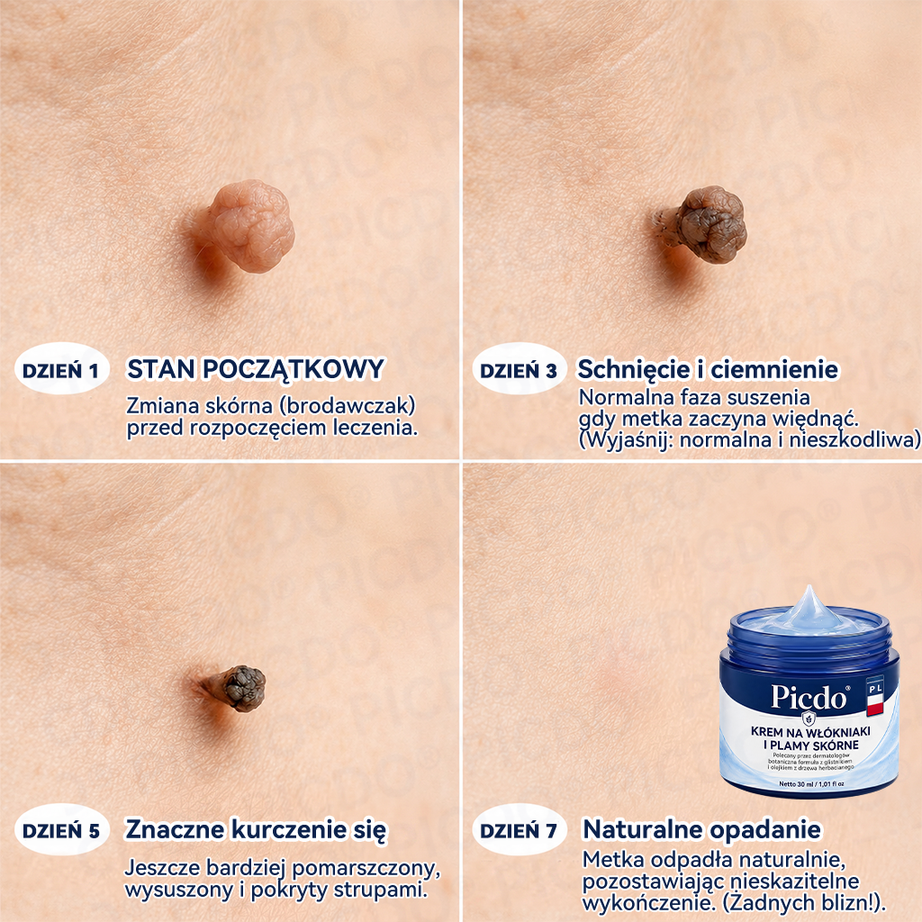 🫛🫛𝐏𝐢𝐜𝐝𝐨® 7-𝐃𝐧𝐢𝐨𝐰𝐲 𝐊𝐫𝐞𝐦 𝐝𝐨 𝐔𝐬𝐮𝐰𝐚𝐧𝐢𝐚 𝐁𝐫𝐨𝐝𝐚𝐰𝐞𝐤 𝐢 𝐍𝐢𝐞𝐝𝐨𝐬𝐤𝐨𝐧𝐚𝐥𝐨ś𝐜𝐢 𝐒𝐤ó𝐫𝐲🩵 (𝑭𝒐𝒓𝒎𝒖ł𝒂 𝑩𝒆𝒛 𝑩ó𝒍𝒖 𝒊 𝑩𝒆𝒛 𝑩𝒍𝒊𝒛𝒏) 💪