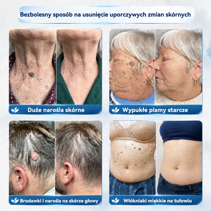 🫛🫛𝐏𝐢𝐜𝐝𝐨® 7-𝐃𝐧𝐢𝐨𝐰𝐲 𝐊𝐫𝐞𝐦 𝐝𝐨 𝐔𝐬𝐮𝐰𝐚𝐧𝐢𝐚 𝐁𝐫𝐨𝐝𝐚𝐰𝐞𝐤 𝐢 𝐍𝐢𝐞𝐝𝐨𝐬𝐤𝐨𝐧𝐚𝐥𝐨ś𝐜𝐢 𝐒𝐤ó𝐫𝐲🩵 (𝑭𝒐𝒓𝒎𝒖ł𝒂 𝑩𝒆𝒛 𝑩ó𝒍𝒖 𝒊 𝑩𝒆𝒛 𝑩𝒍𝒊𝒛𝒏) 💪