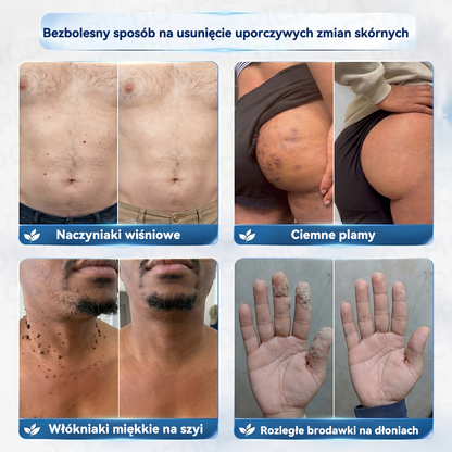 🫛🫛𝐏𝐢𝐜𝐝𝐨® 7-𝐃𝐧𝐢𝐨𝐰𝐲 𝐊𝐫𝐞𝐦 𝐝𝐨 𝐔𝐬𝐮𝐰𝐚𝐧𝐢𝐚 𝐁𝐫𝐨𝐝𝐚𝐰𝐞𝐤 𝐢 𝐍𝐢𝐞𝐝𝐨𝐬𝐤𝐨𝐧𝐚𝐥𝐨ś𝐜𝐢 𝐒𝐤ó𝐫𝐲🩵 (𝑭𝒐𝒓𝒎𝒖ł𝒂 𝑩𝒆𝒛 𝑩ó𝒍𝒖 𝒊 𝑩𝒆𝒛 𝑩𝒍𝒊𝒛𝒏) 💪