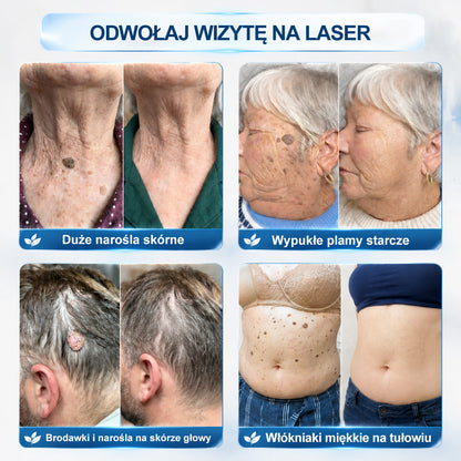 𝐏i𝐜𝐝o®🫛🫛7 𝑫𝒏𝒊 𝑷𝒓𝒆𝒑𝒂𝒓𝒂𝒕 𝑫𝒐 𝑼𝒔𝒖𝒘𝒂𝒏𝒊𝒂 𝑾łó𝒌𝒏𝒊𝒂𝒌ó𝒘 𝑴𝒊ę𝒌𝒌𝒊𝒄𝒉 𝑰 𝑷𝒓𝒛𝒆𝒃𝒂𝒓𝒘𝒊𝒆ń(𝐁𝐞𝐳 𝐁ó𝐥𝐮, 𝐁𝐞𝐳 𝐁𝐥𝐢𝐳𝐧 – 𝐑𝐨𝐥𝐥-𝐨𝐧)