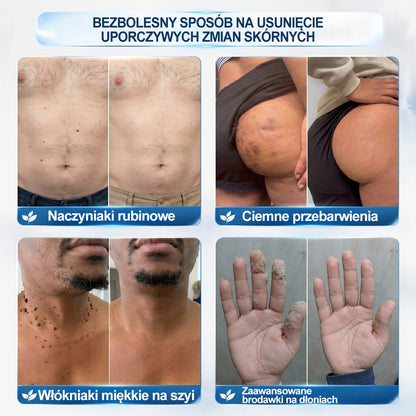 𝐏i𝐜𝐝o®🫛🫛7 𝑫𝒏𝒊 𝑷𝒓𝒆𝒑𝒂𝒓𝒂𝒕 𝑫𝒐 𝑼𝒔𝒖𝒘𝒂𝒏𝒊𝒂 𝑾łó𝒌𝒏𝒊𝒂𝒌ó𝒘 𝑴𝒊ę𝒌𝒌𝒊𝒄𝒉 𝑰 𝑷𝒓𝒛𝒆𝒃𝒂𝒓𝒘𝒊𝒆ń(𝐁𝐞𝐳 𝐁ó𝐥𝐮, 𝐁𝐞𝐳 𝐁𝐥𝐢𝐳𝐧 – 𝐑𝐨𝐥𝐥-𝐨𝐧)