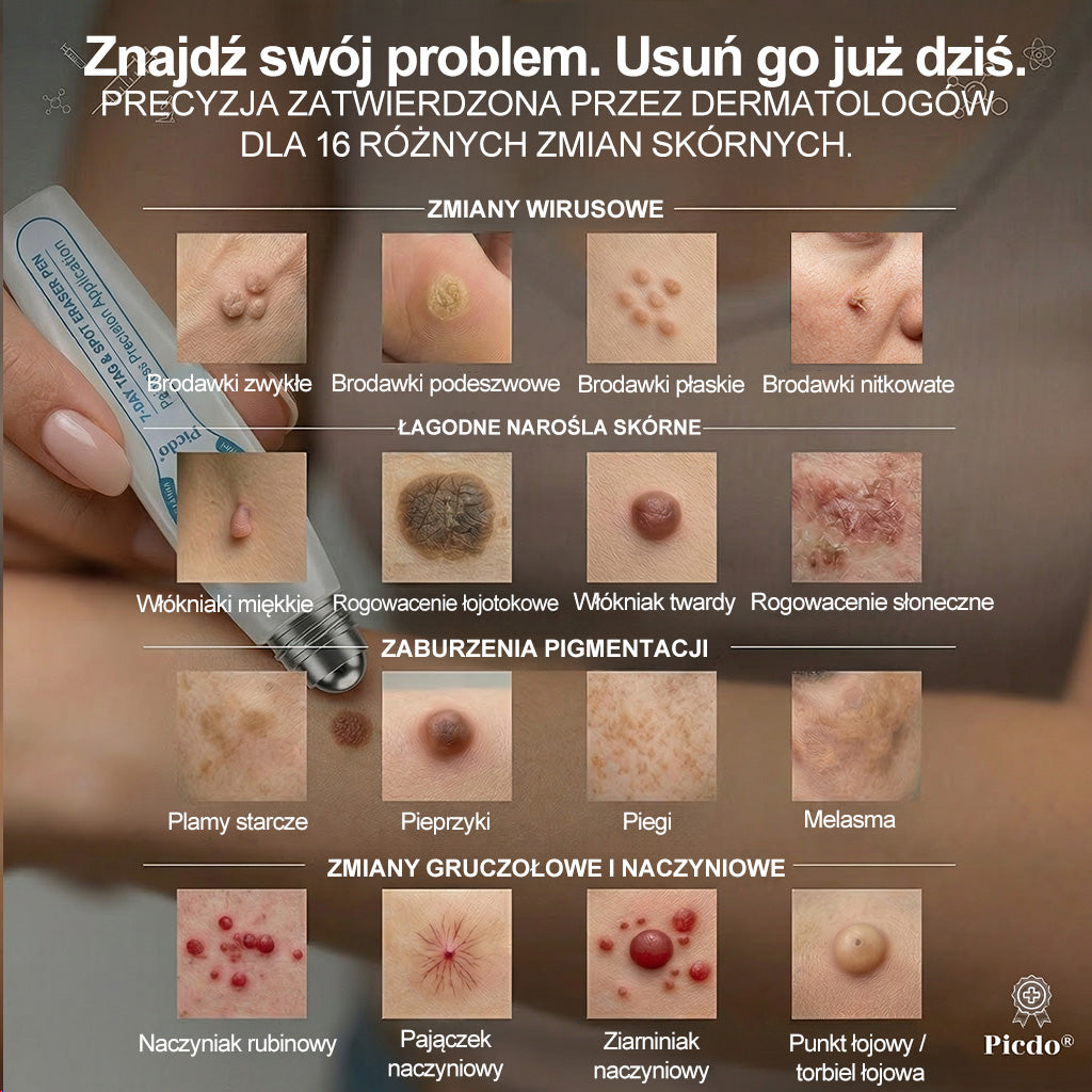 𝐏i𝐜𝐝o®🫛🫛7 𝑫𝒏𝒊 𝑷𝒓𝒆𝒑𝒂𝒓𝒂𝒕 𝑫𝒐 𝑼𝒔𝒖𝒘𝒂𝒏𝒊𝒂 𝑾łó𝒌𝒏𝒊𝒂𝒌ó𝒘 𝑴𝒊ę𝒌𝒌𝒊𝒄𝒉 𝑰 𝑷𝒓𝒛𝒆𝒃𝒂𝒓𝒘𝒊𝒆ń(𝐁𝐞𝐳 𝐁ó𝐥𝐮, 𝐁𝐞𝐳 𝐁𝐥𝐢𝐳𝐧 – 𝐑𝐨𝐥𝐥-𝐨𝐧)